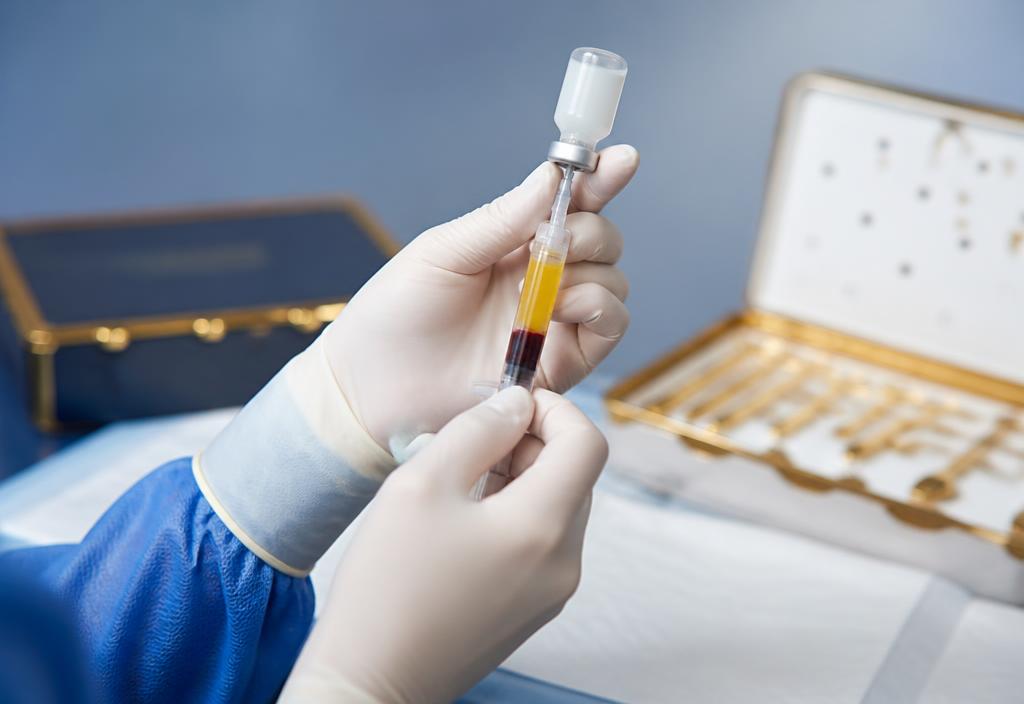 Preparo de material para procedimento de Medicina Regenerativa